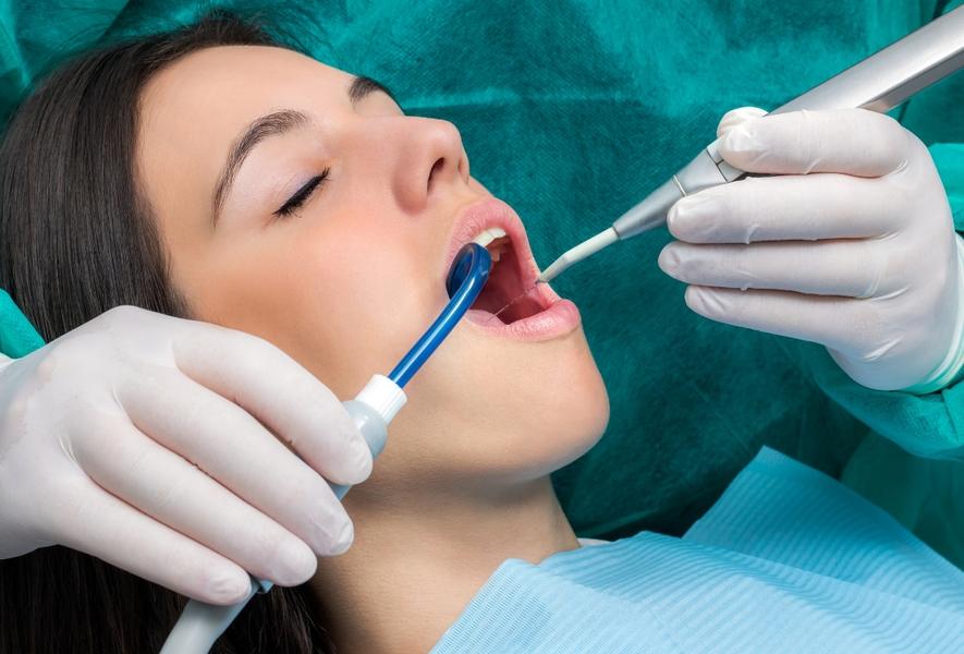 Dent Vita | Ošetření zubního kazu