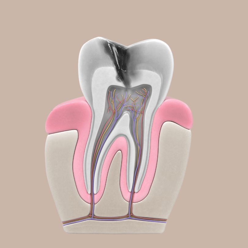DentVita