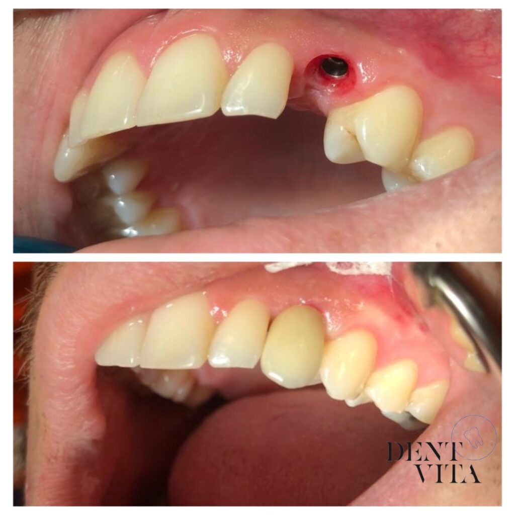 DentVita